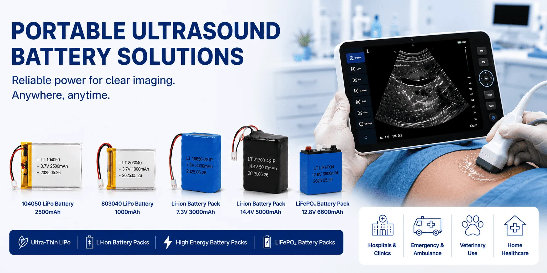 Custom Battery For Portable Ultrasound